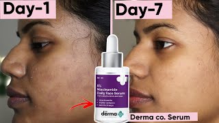 7day Derma Co Serum Challenge You wont believe what happened 😱 [upl. by Palocz]