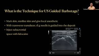 How To Treat Calcific Rotator Cuff Tendinopathy Ultrasound Guided Barbotage and PRP Injection [upl. by Bennie]