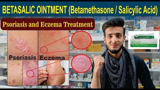 BETASALIC OINTMENT Betamethasone  Salicylic Acid  Uses Side Effect Application amp Complete info [upl. by Birdie]