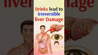 Drinks lead to irreversible liver damage [upl. by Norling]