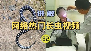 4K  网络热门长虫视频82年仅13岁男孩网购银环蛇当宠物？刚买来就被咬进ICU险些丧命！【世界记忆大师龙雅】 [upl. by Nappie]