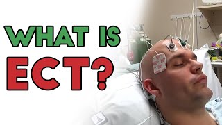 What is Electroconvulsive Therapy ECT [upl. by Mercedes]