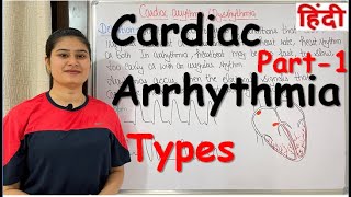 Cardiac Arrhythmia  Part1  Types of Cardiac Arrhythmia  RajNEET Medical Education [upl. by Donohue]