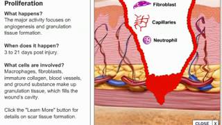 Stages of Wound Healing Process [upl. by Anor]