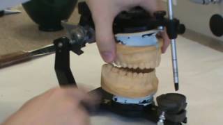 12 How to make and mount Diagnostic Casts  Mounting Mandibular Cast on Hanau Aticulator [upl. by Anyk143]