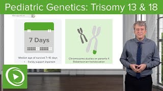 Trisomy 13 amp 18 – Pediatric Genetics  Lecturio [upl. by Nivad]