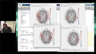 Motion Correction Walkthrough in NIRS Toolbox Brain AnalyzIR with Dr Ted Huppert [upl. by Shama]