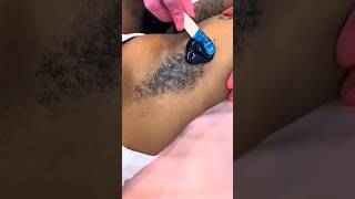 satisfying underarm waxing shorts satisfying wax asmr waxing [upl. by Atimad543]