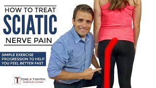 How To Treat Sciatica  Effective Home Exercise Progression For Sciatic Nerve Pain [upl. by Clement]