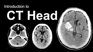 Introduction to CT Head Approach and Principles [upl. by Kcirdehs]