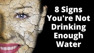 8 Signs of Dehydration You Are NOT Drinking Enough Water [upl. by Kyl]