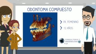 1 Odontoma Compuesto [upl. by Nerua]