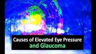 Causes of Elevated Eye Pressure and Glaucoma [upl. by Len]