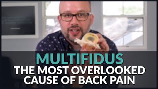 Multifidus The Most Overlooked Cause of Low Back Pain [upl. by Doownyl]