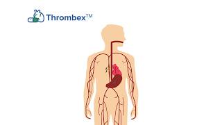 Kardiatonos Myths Facts and Treatments for Cardiovascular Disease CVD [upl. by Donadee]