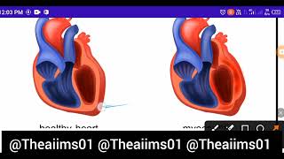 Myocarditis Heart diseases MNS topic for NORCET preparation Bsc nursing Gnm ANM competitive exams [upl. by Hilda]