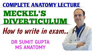 Meckels Diverticulum  Anatomy [upl. by Padriac]