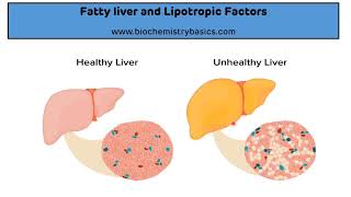 Fatty Liver  Lipotropic Factors  Causes of Fatty Liver  Biochemistry [upl. by Barram]