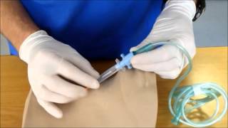 Needle Cricothyroidotomy [upl. by Hamburger74]