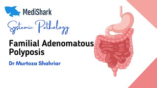 Systemic Pathology Familial Adenomatous Polyposis Dr Murtoza Shahriar [upl. by Rance884]