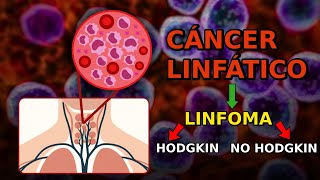 LINFOMAS  Un CÁNCER del SISTEMA INMUNE🩻 [upl. by Janette990]