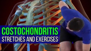 Costochondritis Stretches amp Exercises Thoracic and Rib Mobility [upl. by Stasny]