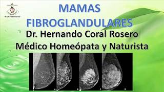 MAMAS FIBROGLANDULARES MASA BENIGNA EN MUJERES JÓVENES POR ESTIMULO HORMONAL [upl. by Carlin]