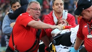 Fan hit in head by broken bat [upl. by Jew]