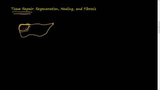 31 Tissue Repair Regeneration Healing Fibrosis [upl. by Coke]