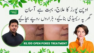 Open Pores Removal treatment at home by Dr Essa Herbalist  Green Roots [upl. by Eustacia]