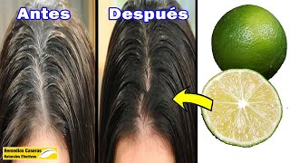 No Necesitar Tinte  Convertir Las Canas En El Pelo Negro Rápidamente Con 3 Ingredientes [upl. by Prouty]