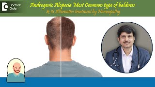 BaldnessAndrogenic AlopeciaAlternative Treatment by Homeopathy DrSanjay PanickerDoctors Circle [upl. by Morena]