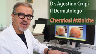 Agostino Crupi  Le Cheratosi Attiniche come curarle [upl. by Riannon]