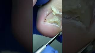 Satisfying pedicure video pedicure toenails [upl. by Madid]