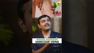 Can Certain Foods REALLY Reduce Varicose Veins [upl. by Adnulahs]