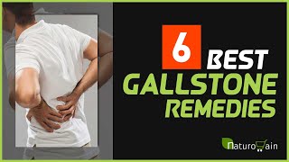 Gallstone Causes Symptoms Remedies and Best Treatment [upl. by Nessah187]