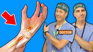 Carpal Tunnel Syndrome  Causes and Treatments [upl. by Cohby257]