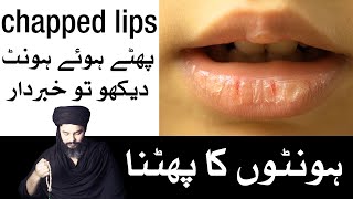 Chapped Lips Hont Phatain to Khabardar Mehrban Ali  Mehrban TV [upl. by Lehcnom464]