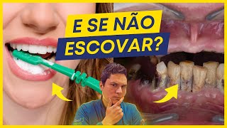 7 CONSEQUÊNCIAS CHOCANTES DE NÃO ESCOVAR OS DENTES [upl. by Lilias449]