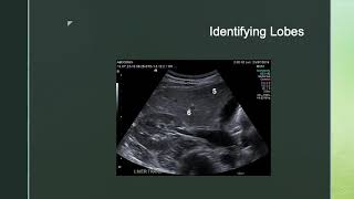 Ultrasound and Liver Segments [upl. by Warga]