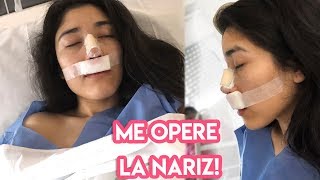 ME OPERÉ LA NARIZ  mi RINOPLASTIA día con día [upl. by Jannelle]