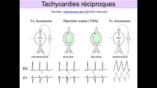 ECG indispensables en SAMU et urgence Partie 3 Tachycardies Dr Taboulet [upl. by Sinnel]