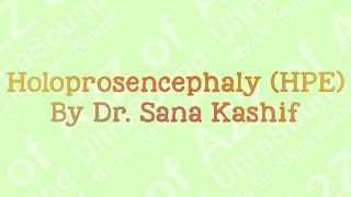 Ultrasound features of Holoprosencephaly HPE  A2Z of Ultrasound [upl. by Arjan]