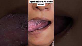 Skin Diseases dermatologist Dr Bhutada Skin India [upl. by Htebaile]