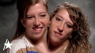 Conjoined Twin Abby Hensel Of Abby amp Brittany Is MARRIED [upl. by Asirralc]