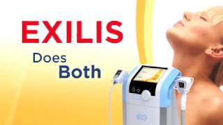 BTL Exilis FACE WEBISODE [upl. by Pussej632]