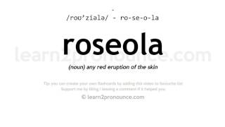 Pronunciation of Roseola  Definition of Roseola [upl. by Yregerg774]