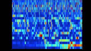 SCHIZOPHRENIA AS SOUND listening to the dynamic brain [upl. by Forrest]