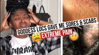 Getting Faux Locs Pain Sores amp Scabs  HeyLayah [upl. by Jennette]