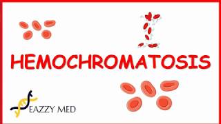 Hemochromatosis causespathophysiologysigns and symptomsdiagnosis and treatment [upl. by Joscelin]